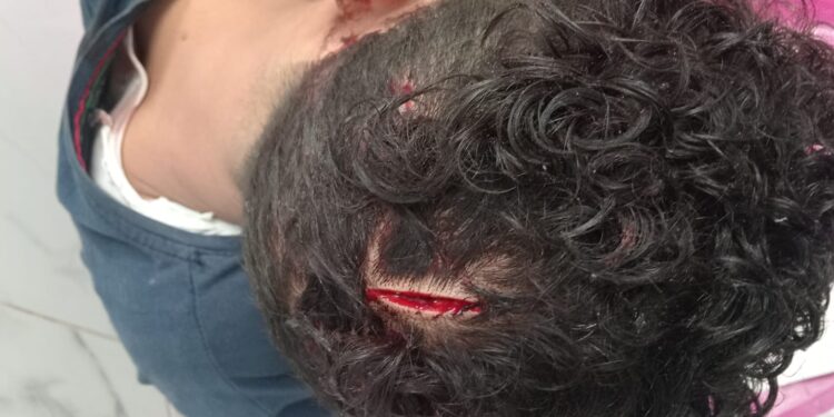 إصابة شاب بجرح قطعي بفروة الرأس وجرح بالكتف في تعدٍ بالعمرانية